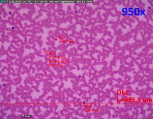 DinoLiteUS's tweet photo. 🔬 Prepared Microscope Slide of Blood Cells.
📸 The first image was taken with a standard model, the second image was taken with AM4515T8
#digital #microscope #digitalmicroscope #dinolite #edtech #science #blood #cells #microscopeslide https://t.co/lOcfyLKRRa