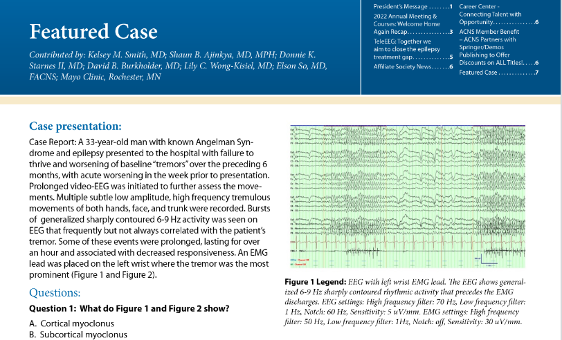 ACNS_org's tweet photo. Have you checked out the Featured Case yet? 

A 33-year-old man with known Angelman Syndrome and epilepsy presented to the hospital with failure to thrive and worsening of baseline “tremors” over the preceding 6 months... 

What does his EEG show? 

https://t.co/iOCuo1muDY https://t.co/0jqZdNCFP3
