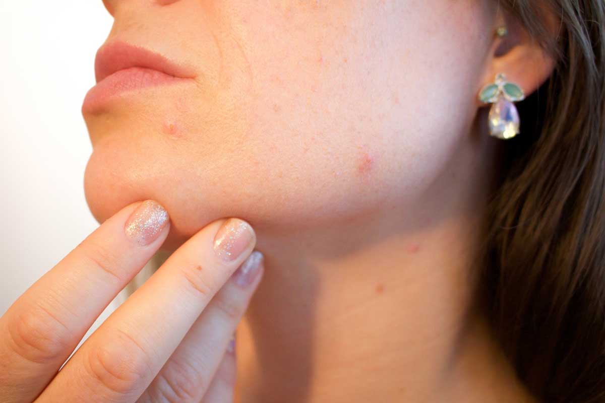 amexpharma's tweet photo. skin irritation? We specialize in customized dermatology treatments and are happy to consult with your dermatologist to discuss customized medications. https://t.co/3VHEyIOuF6