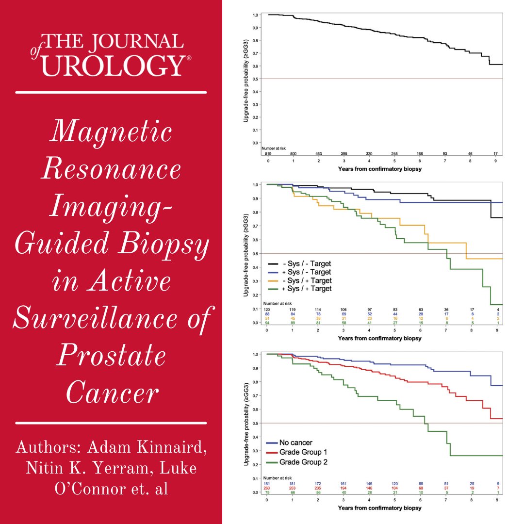 Journal of Urology (@jurology) on Twitter photo "Magnetic Resonance Imaging-Guided Biopsy in Active Surveillance of Prostate Cancer" #UroSoMe
🔗ow.ly/pFgM50Iqqys🔗
By: <a href="/AdamKinnaird/">Adam Kinnaird</a>, <a href="/NitinYerram/">Nitin Yerram M.D.</a>, <a href="/LOConnor_/">Luke O'Connor, DO</a>, <a href="/wayne_brisbane/">Wayne Brisbane</a>, <a href="/vidit_sharma_/">Vidit Sharma</a>, <a href="/RajivJayadevan/">Rajiv Jayadevan MD</a>, <a href="/MichaelAhdootMD/">Michael Ahdoot MD</a>, <a href="/UroMADMD/">Michael Daneshvar</a>, @RobertReiterMD et al. "Magnetic Resonance Imaging-Guided Biopsy in Active Surveillance of Prostate Cancer" #UroSoMe
🔗ow.ly/pFgM50Iqqys🔗
By: <a href="/AdamKinnaird/">Adam Kinnaird</a>, <a href="/NitinYerram/">Nitin Yerram M.D.</a>, <a href="/LOConnor_/">Luke O'Connor, DO</a>, <a href="/wayne_brisbane/">Wayne Brisbane</a>, <a href="/vidit_sharma_/">Vidit Sharma</a>, <a href="/RajivJayadevan/">Rajiv Jayadevan MD</a>, <a href="/MichaelAhdootMD/">Michael Ahdoot MD</a>, <a href="/UroMADMD/">Michael Daneshvar</a>, @RobertReiterMD et al.