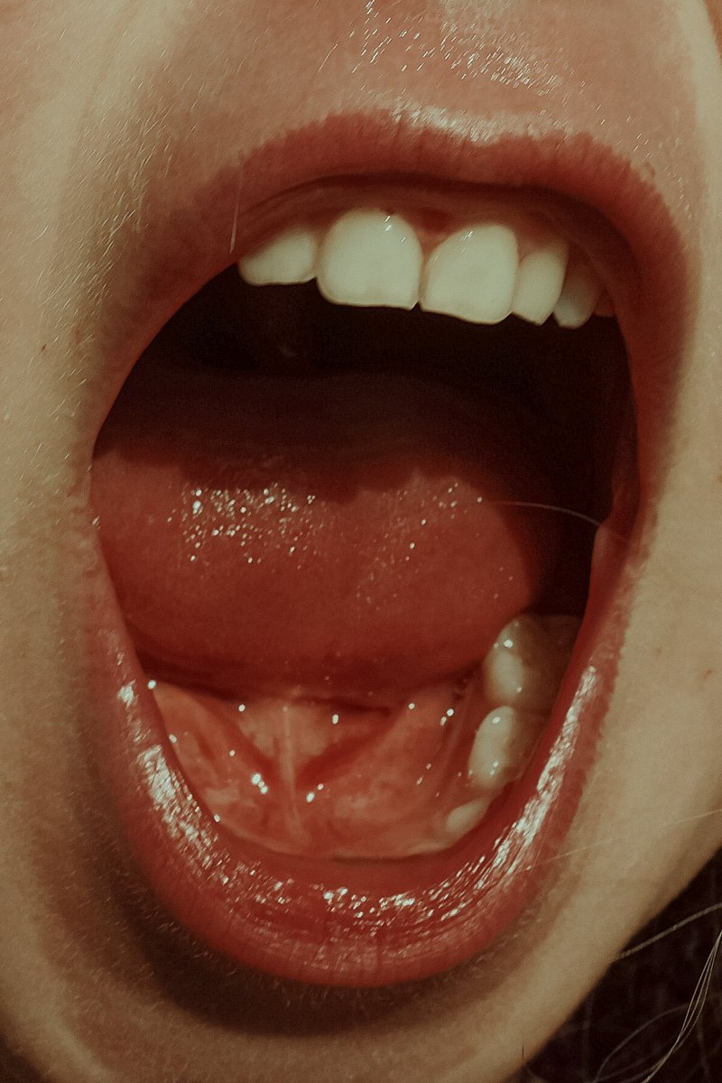 ___zual__'s tweet photo. Afternoon.. seems I can’t stay away for too long. Covid is restricting us in many ways. My photos seem to be my only outlet, the only thing I do for myself actually. Motherhood takes up nearly every avenue I have. 

- Covid mouth and the first flat I lived in as a baby - https://t.co/2KRaKuC6nE