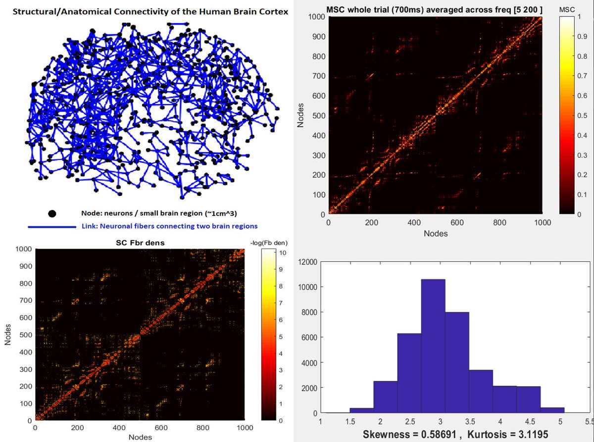 network_iConn's tweet photo. Time to hear from #ESR|11, @karittevlis: The goal of my PhD is to describe the function of the ‘sleepy’ brain using #networks and #GraphTheory tools. To achieve that, #SourceLocalization of the generators of the sleep events with high spatiotemporal resolution should be achieved. https://t.co/kLxdokoMWQ