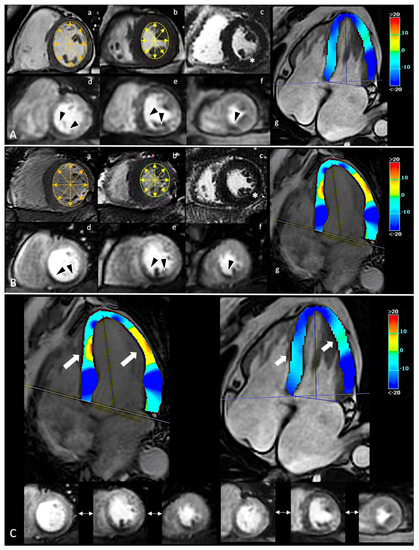 fwkan's tweet photo. Advances in Cardiovascular Magnetic Resonance https://t.co/aPSnxj6eDG #mdpidiagnostics via @diagnostic_mdpi https://t.co/pT1lyQCMCe