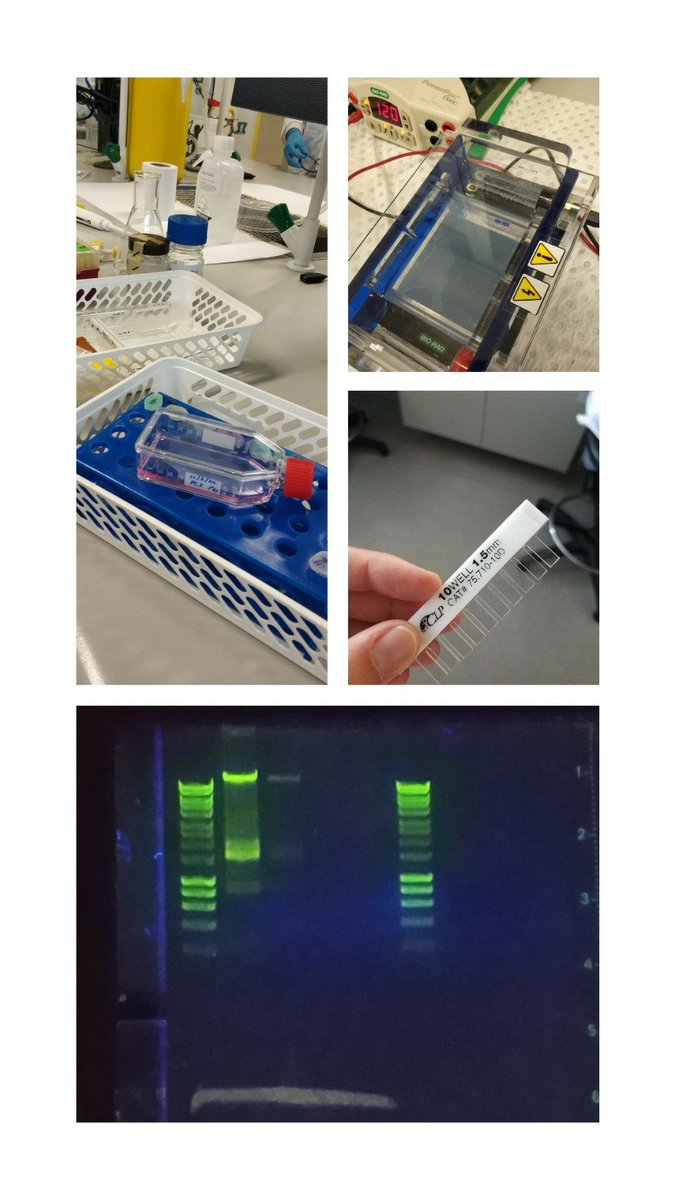 priscilaferraz_'s tweet photo. I am happy to share that I participated in a DNA isolation &amp; analysis practical at #rmituniversity school of science.
 
Extracted the DNA sample, prepared electrophoresis gel for electrical mobility, used UV transilluminator for data collection .
#science #Biotechnology #DNA https://t.co/V0YuEA58cj