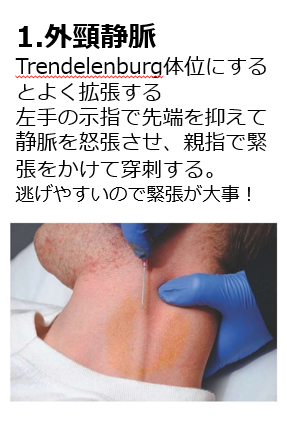 茨城の「墨子」に俺はなる！ひたちなかGIM：柴﨑俊一 على X