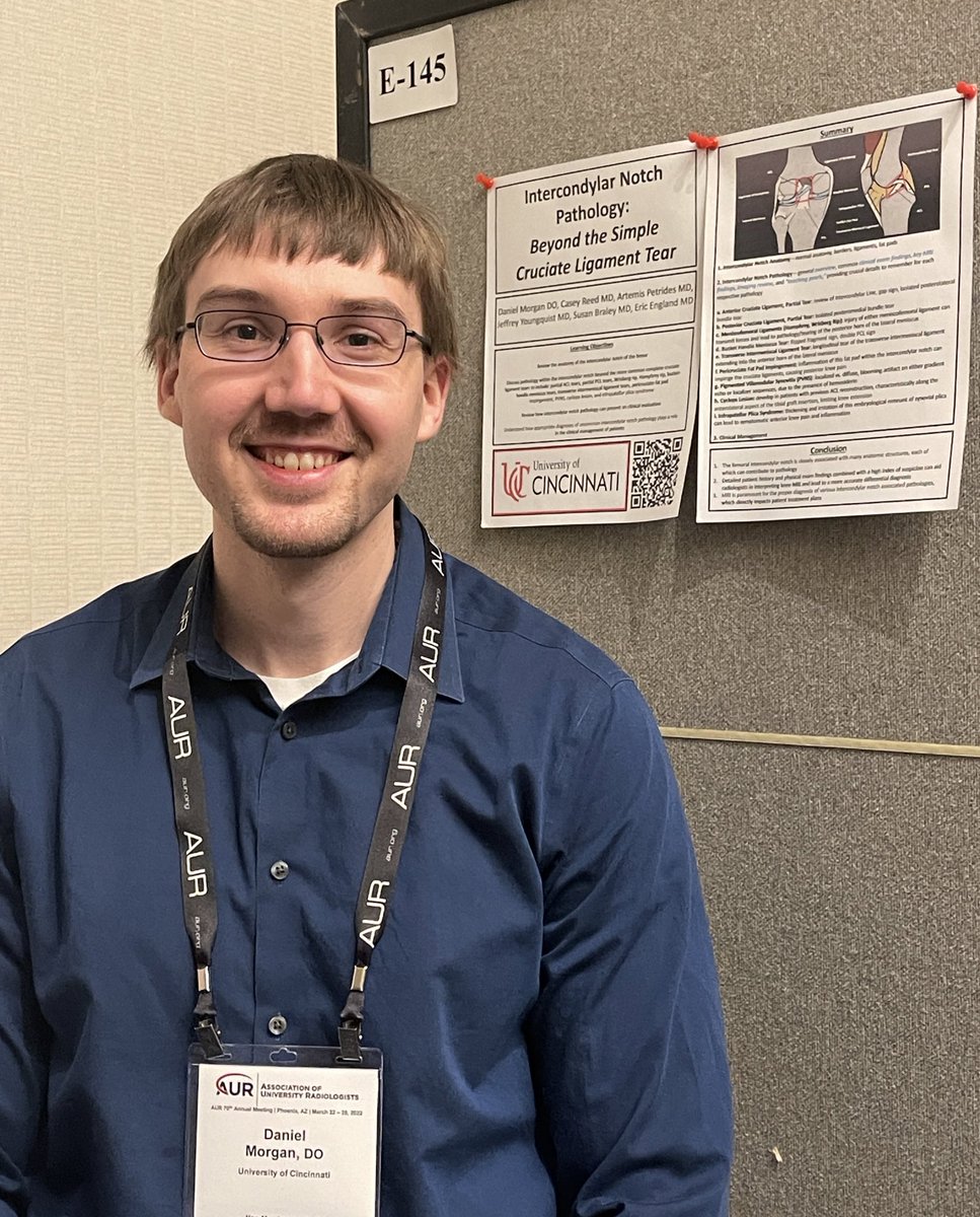 Proud of our resident Daniel Morgan for great work on our poster!  Check it out if you get a chance.  E-145 Intercondylar Notch pathology:  Beyond the Simple Cruciate Ligament Tear. <a href="/UCRadRes/">UCRadRes</a> #AUR22