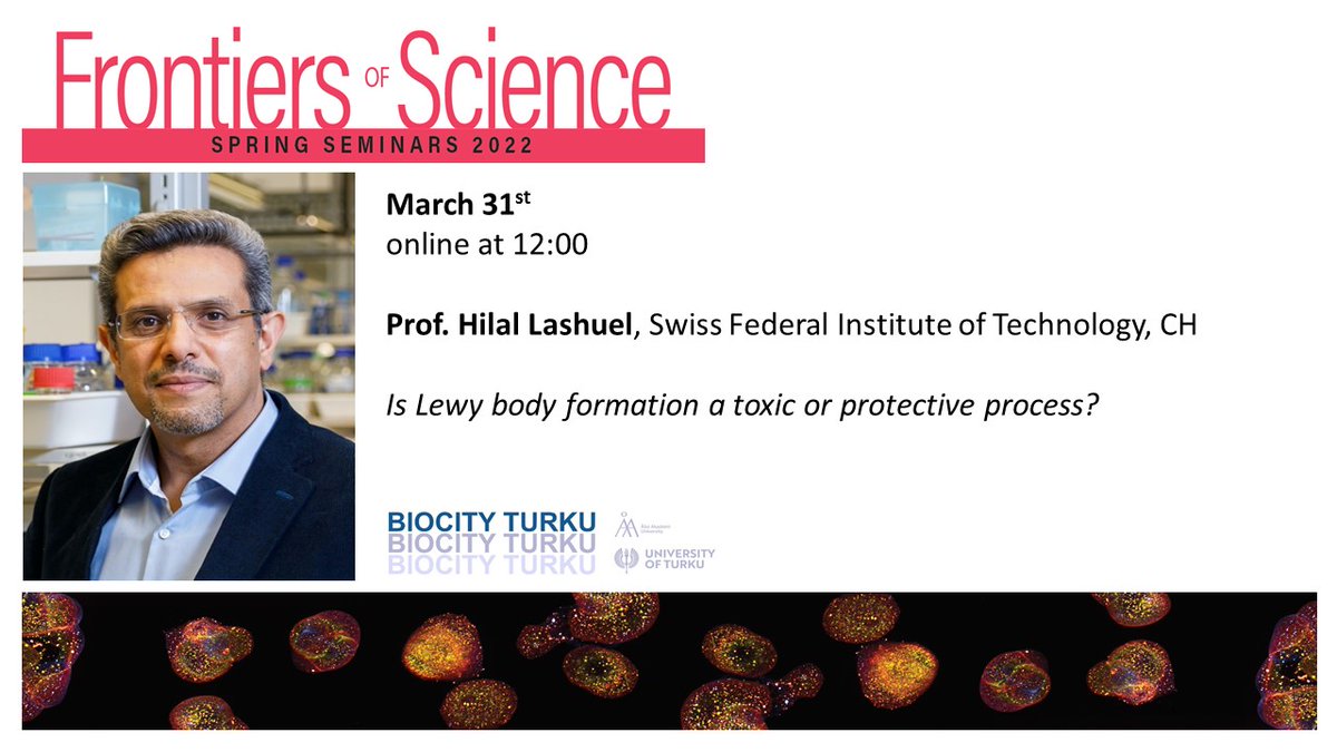 BioCity Turku (@biocityturku) on Twitter photo Next week amazing #frontiersofscience eTALK by @Hlashuel!
#research people in <a href="/UniTurku/">Turun yliopisto - University of Turku</a> <a href="/AboAkademi/">Åbo Akademi University</a> and <a href="/OrionPharma/">Orion Pharma</a> register latest next week Wednesday!
bit.ly/3wyshVw Next week amazing #frontiersofscience eTALK by @Hlashuel!
#research people in <a href="/UniTurku/">Turun yliopisto - University of Turku</a> <a href="/AboAkademi/">Åbo Akademi University</a> and <a href="/OrionPharma/">Orion Pharma</a> register latest next week Wednesday!
bit.ly/3wyshVw