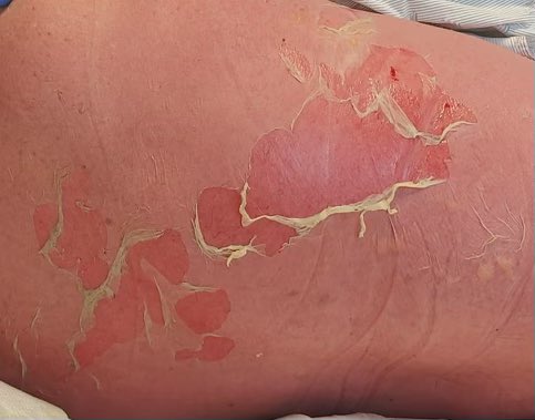 Barry Chan 陳天昕 tweet media