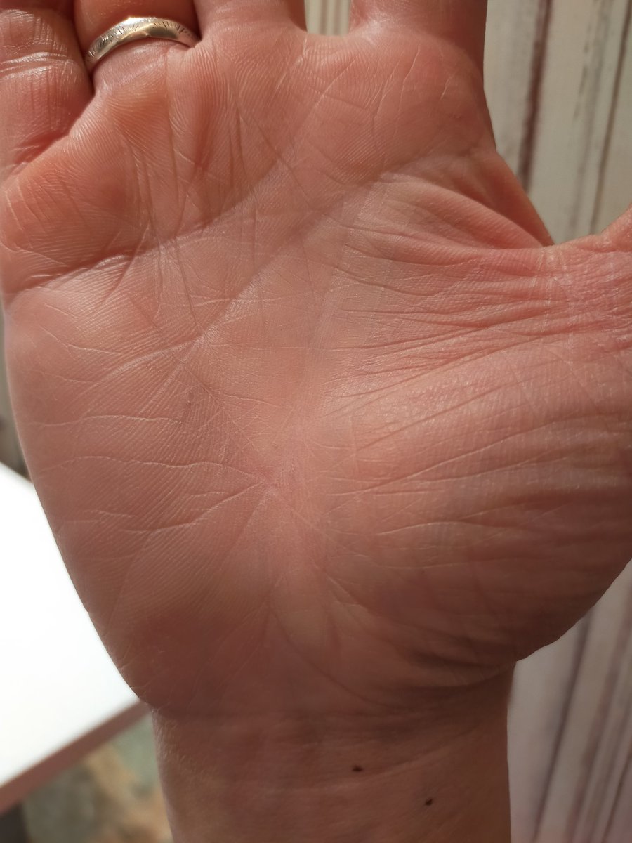 大変です コロナに感染したら右手の生命線が消え始めています 感染1か月目にして気がつきました コロナ コロナ後遺症 手相 22 03 24 神楽坂ねこの郵便局というなまえのお店 大変です コロナに感染したら右手の生命線が消え始めています 感染1か月目にして気がつきました コロナ コロナ後遺症 手相 22 03 24 神楽坂ねこの郵便局というなまえのお店
