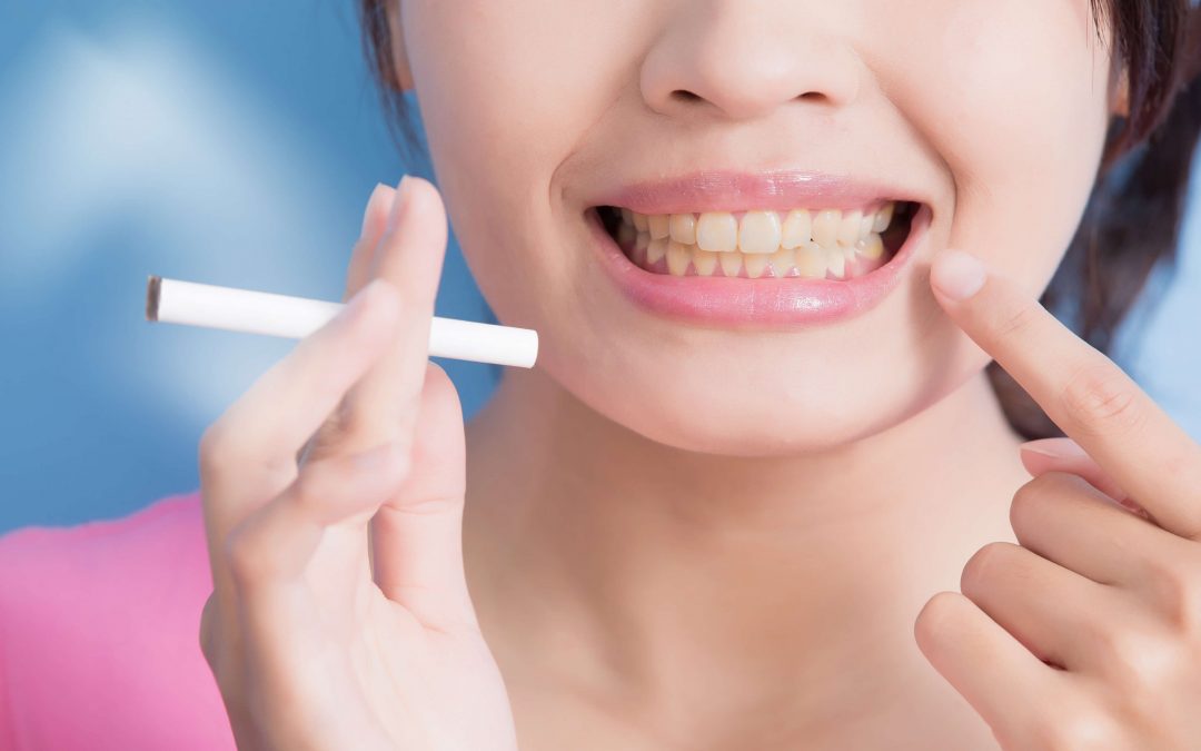 CrescentFamily's tweet photo. How smoking affects your teeth

https://t.co/7kvWCliiDX ⬅️⬅️Click Here to Read More...

#CrescentFamilyDental
#DentistAnaheimCA
#DrKevinHuang https://t.co/PMEI2CvBcP