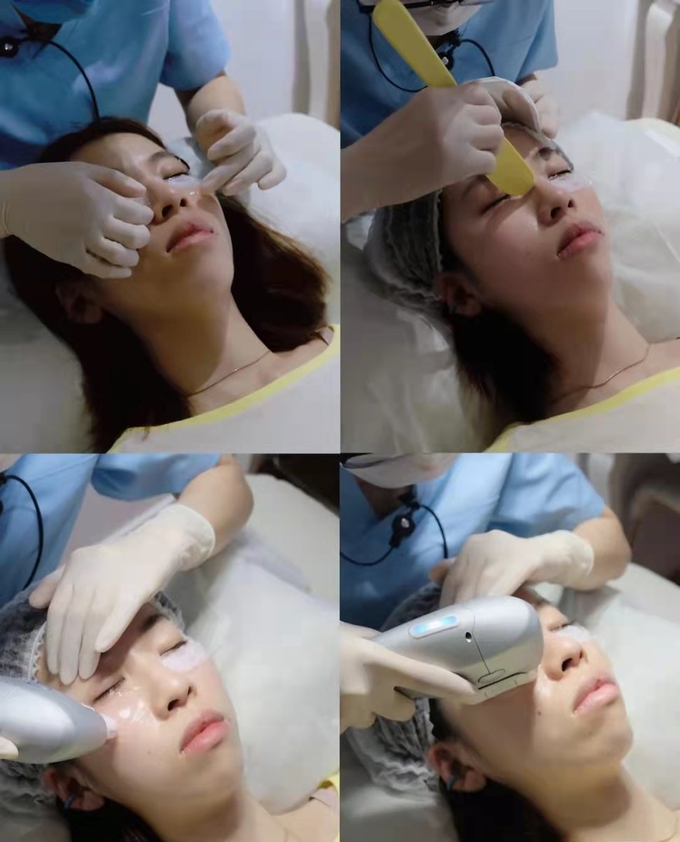 EVALASERTECH's tweet image. Thanks for the picture share,❤️❤️❤️
#hifu #hifufacial #7dhifu #bodybuilding #bodyshape #neckwrinkles #doublechin #doublechinremoval #eyebrows #skinlifting #skintightening #skincare #HIFU #wrinkleremoval