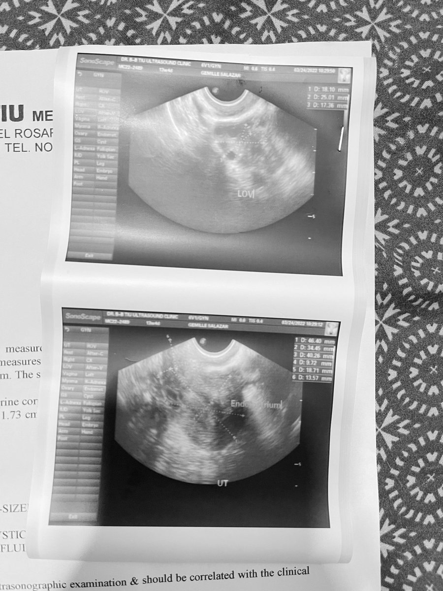gemilleslzr's tweet image. Another battle 🥺 
#pcos #fightpcos