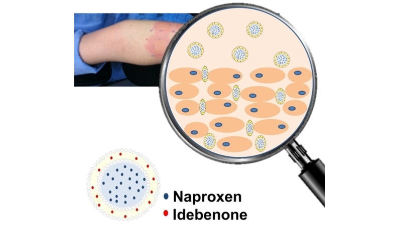 ChemMedChem's tweet photo. Multidrug Idebenone/Naproxen Co-loaded Aspasomes for Significant in vivo Anti-inflammatory Activity (Paolino, Fresta) @paolinodonatell @ChristianCelia8 #openaccess https://t.co/86lFykfhVd https://t.co/j1hzWQJ7vQ