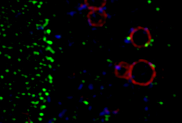 Notably, using 3D-SIM super-resolution microscopy in JFH1 HCVcc-infected cells, we show that Nup98 is apposed at the edges of lipid droplets covered by #HCV core protein!
Nup98: green channel
HCV core: red channel
HCV NS5A: blue channel
3/3