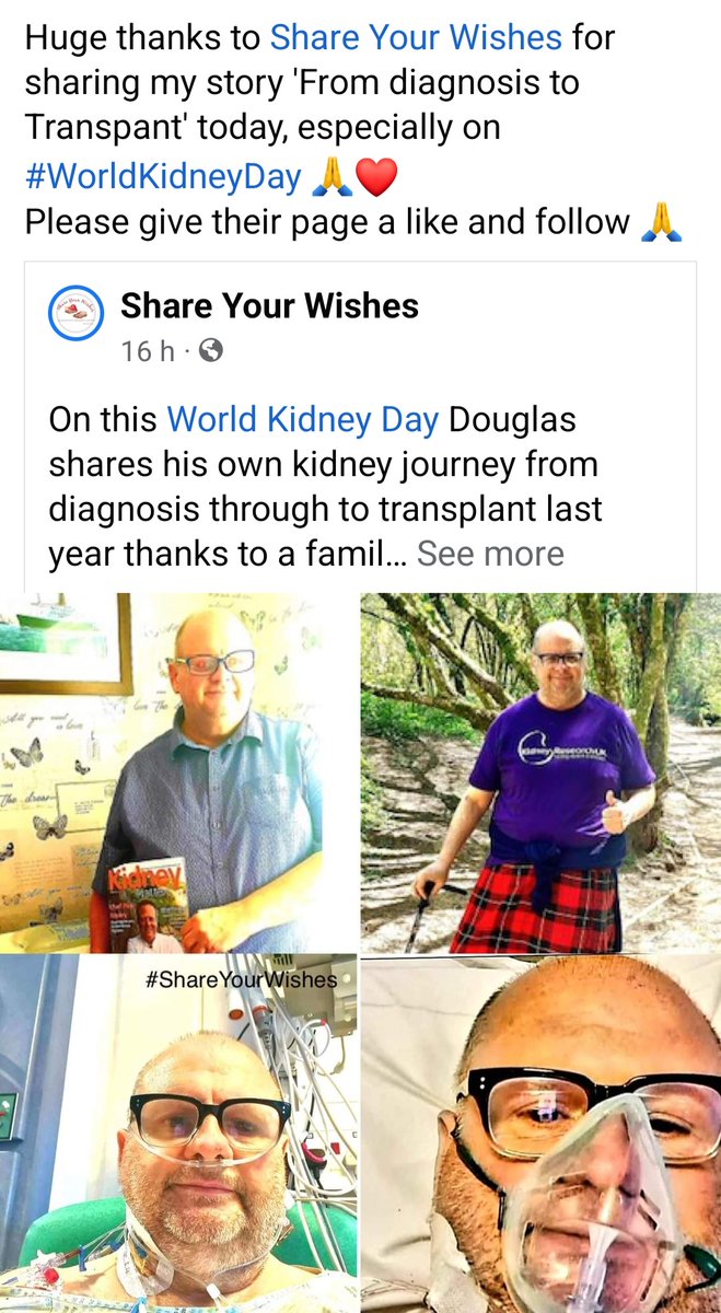 DougKer39026136's tweet photo. 🗣 Today is my 1️⃣st #kidneyversary 🎉 you can celebrate with me for the price of a takeaway ☕️ supporting @Kidney_Research ⬇️
https://t.co/lbAdtR2tX7
Read full story here ⬇️
https://t.co/OlypvJyTZE
You too can help raise #Awaremess by #Retweeting 🙏💜 #TeamKidney #KidneysMatter https://t.co/i0c0lWgSxr
