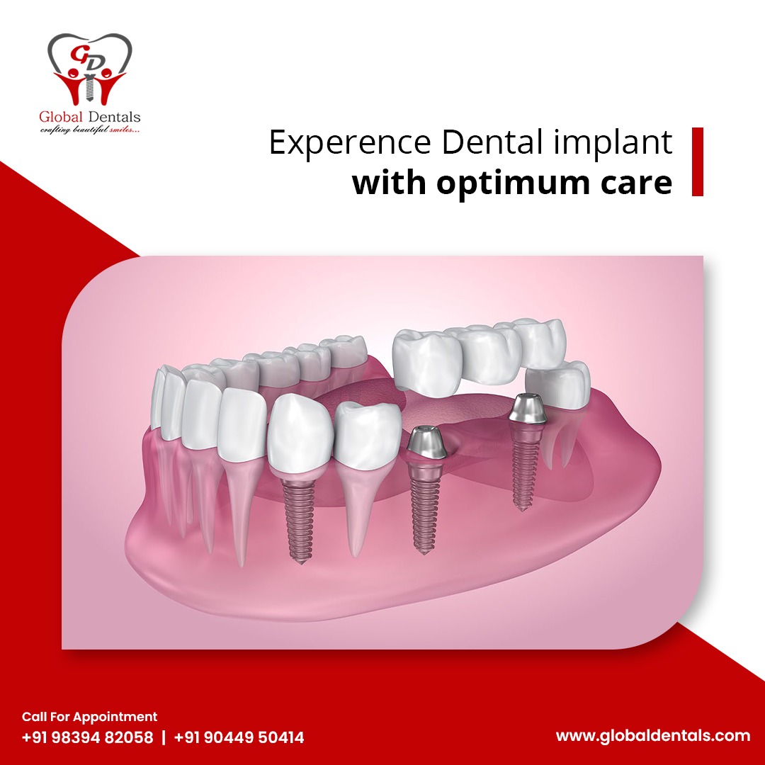 At Global Dentals we do experience dental implants with optimum care. Dental implants are designed to look, feel, and function like your natural teeth.

Call : +91 9839482058
https://t.co/kUQ2BdRlhB

#DentalImplants #HealthySmile #Dentalimplants #OptimumCare #Dentist #Gorakhpur https://t.co/ApXxKI6ZQh