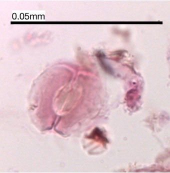 wfins's tweet photo. @PalyAlly @Cesar_Lutiako In rare cases, also stomata of Angiosperms can be found. See for instance a Fagus stoma found in a small forest hollow https://t.co/t23zkzCdNN. https://t.co/YgORlkVnIb