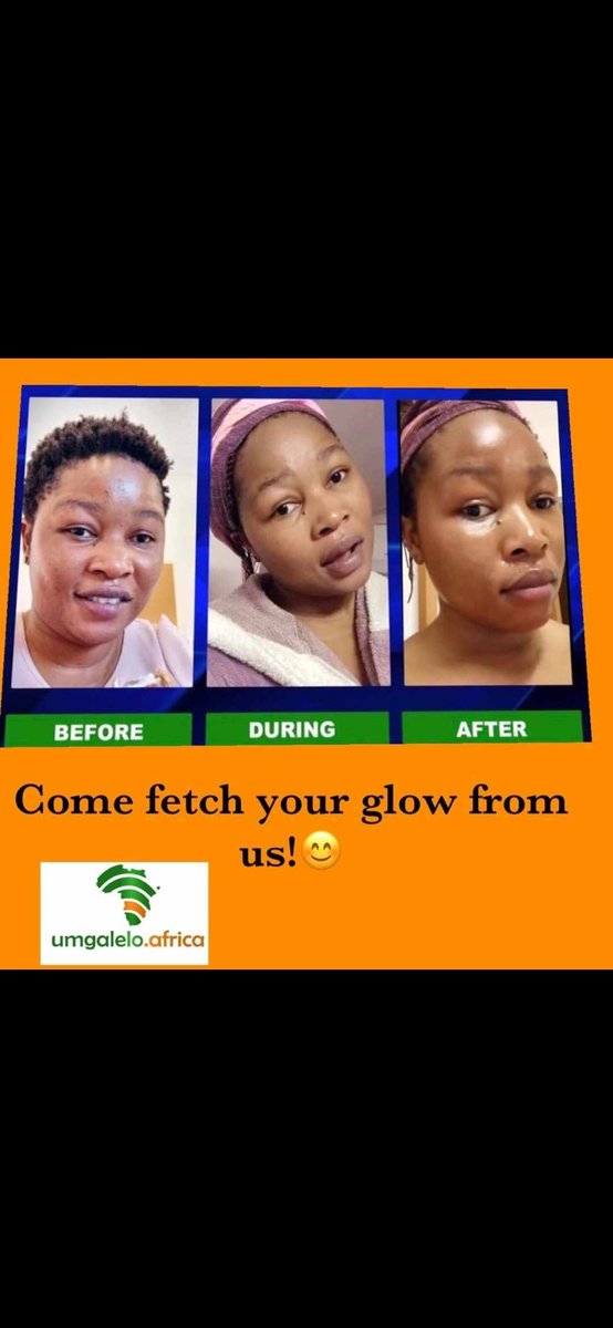 k_mkhensi's tweet photo. #10pM

#umgaleloafrica provides skin products, v-cleanser and steaming herbs🔥🔥 to provide solutions of skin problems like dry skin, pimples, darks spots, bacterial growth and period pains. For more information text me on 082 858 4839 🔥🔥 https://t.co/TDGlbIVdbx