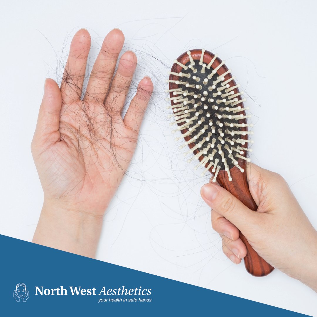 #HairLoss affects approximately two-thirds of men. Follicular Unit Extraction, or #FUE, brings life back to the #scalp. Read our latest #blog to discover how our most natural-looking #HairTransplant could change your life. 

northwestaesthetics.co.uk/blog/all-you-n…