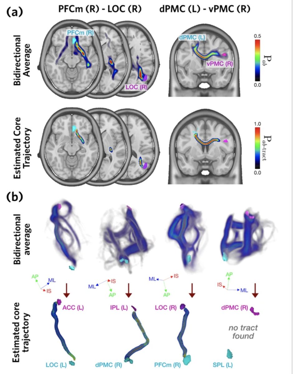 How to analyze tracts running between pre-defined (functional) regions?

Great to finally see this paper led by @atypical_me on trajectory estimation and assessment out !!

nature.com/articles/s4200…

Source code for all procedures available here: doi.org/10.5281/zenodo…