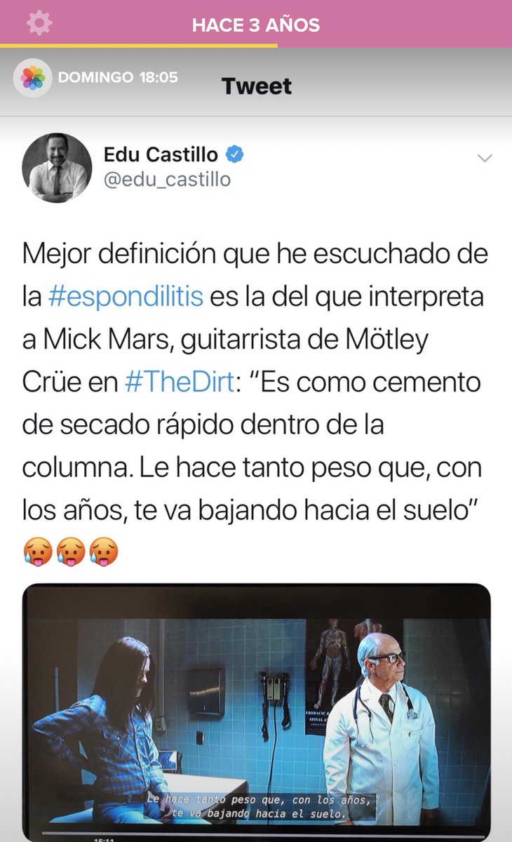 edu_castillo's tweet photo. Esto lo publiqué un día como hoy hace tres años, cuando me sentía tal como Mick Mars y no veía salida (además del abuso de antinflamatorios que me tenían comprometido el hígado). Gracias a la maravillosa medicina biológica, mi vida hoy es muy distinta ❤️ #espondilitis #simponi https://t.co/j1CImeudJU