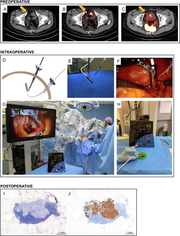 European Urology tweet media
