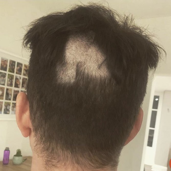 itsrichwilliams's tweet photo. Clocks changing this weekend; if you could have an hour back from the last year again, which would it be?
I’d go back to the hour I tried my DIY haircut &amp; say “STEP AWAY FROM THE CLIPPERS…” https://t.co/7JtFkTeFBq