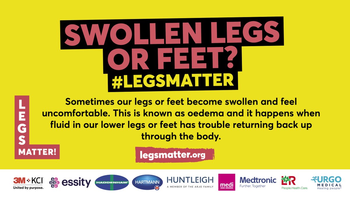 Do you suffer from swollen legs and feet - check out our information on oedema and lymphoedema, we have lots of great resources to help you understand and manage these conditions. legsmatter.org/help-informati… #legsmatter #lymphoedema