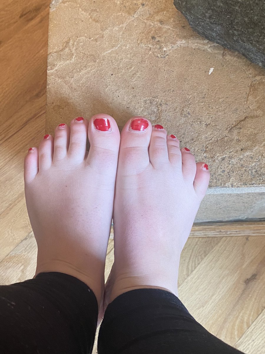 midgetfeet9502's tweet photo. These little toes are ready for a touch up, what color is next? You tell me 💋 #Feet #feetworshi̇p #FeetFinder https://t.co/CumKLM6p5d