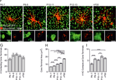 ARVOiovs's tweet photo. Babai et al @UniFAU investigate the role of the synaptic ribbon in the release of synaptic vesicles in their latest @ARVOIOVS article. 
https://t.co/R8hUwQKgKd https://t.co/gGXlVy7aMv