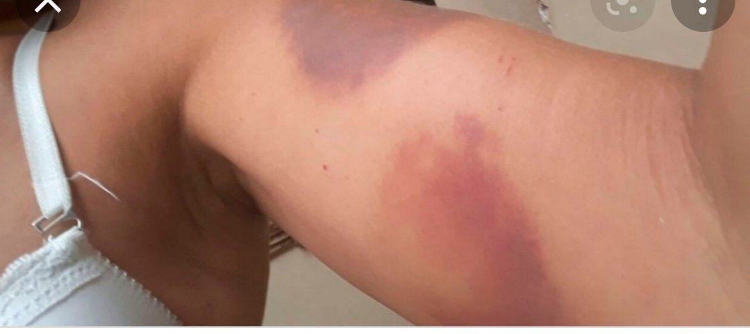 Asociación Fibromialgia Cuarta Región tweet media