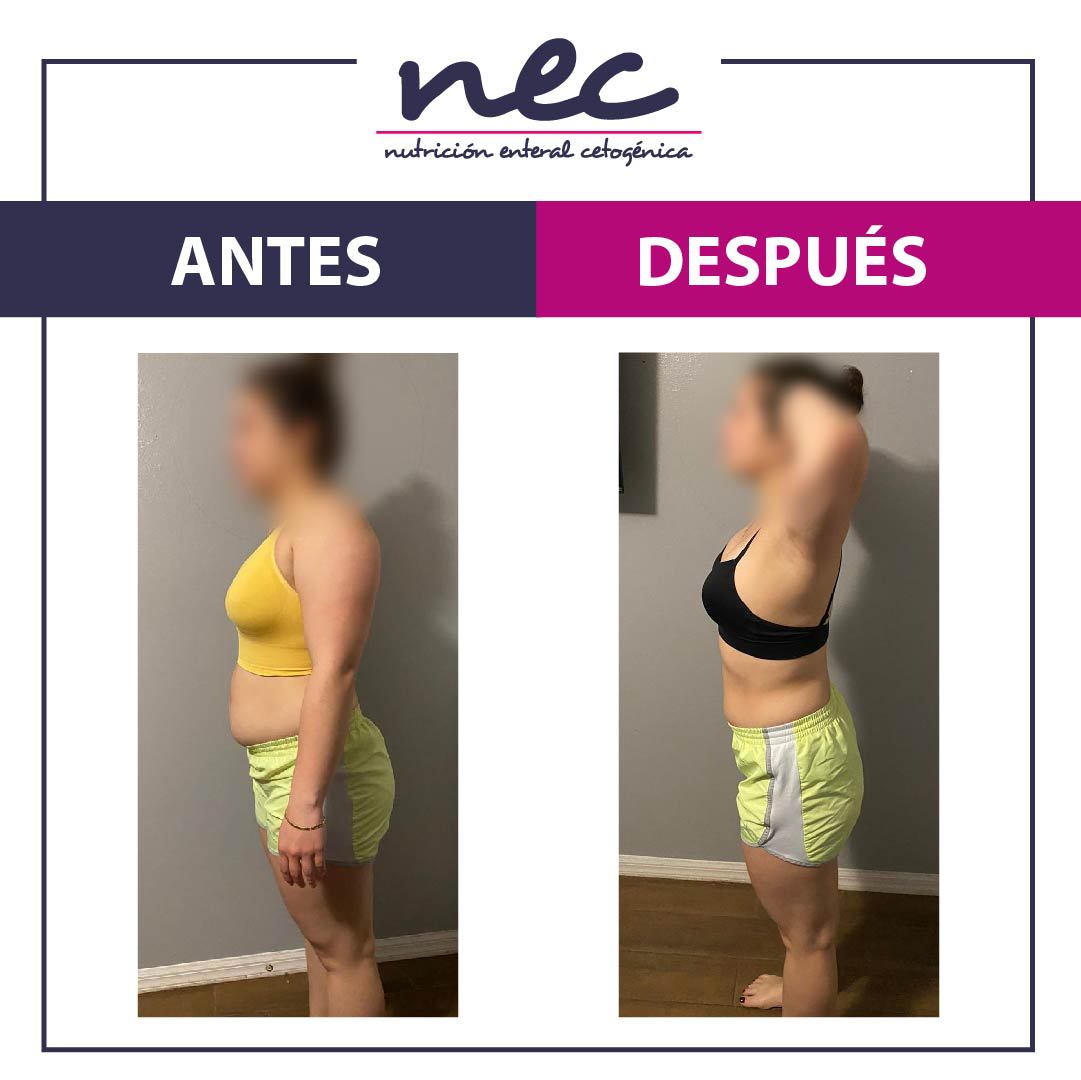 MetodoNec's tweet photo. Nuestra paciente nos compartió su cambio, en donde logro disminuir significativamente su porcentaje de grasa durante los 10 días con Método NEC. 
-
#métodonec #bajardepeso #bajardepesorapido #proteinas #estilodevidasaludable #adelgazar #keto #ketodieta #cetogenica #nec https://t.co/1q79CSFeYu
