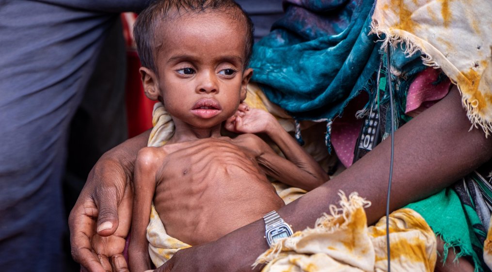 AJEnglish's tweet photo. “It’s incredibly difficult because you have to choose which areas and populations need help the most.”

How the drought in Somalia is worsening by funding gap amid Russia's invasion of Ukraine — in pictures https://t.co/7Jv4v53hV2 https://t.co/EZblY2h2Fn