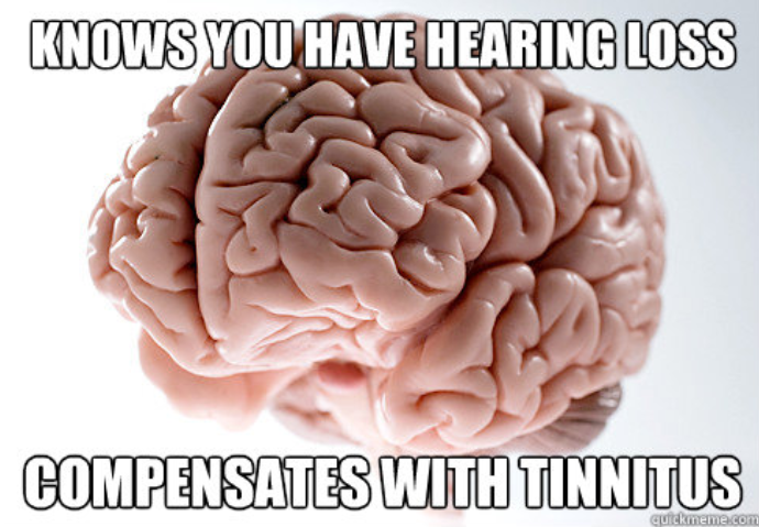 soundfairaus's tweet photo. Happy Friday!
#TGIF #scumbagbrain
Image description: A brain with the caption "knows you have hearing loss - compensates with tinnitus". https://t.co/UddKWDxh90