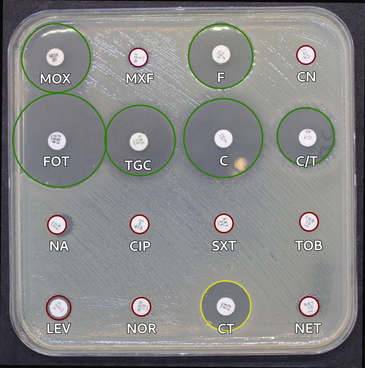 alex_muntean's tweet photo. How #medical #microbiology laboratories check #AntibioticResistance in Enterobacterales. First one of the most frequent: E.coli #ESBL. This can lead to 3rd generation #cephalosporin resistance and #synergy (expanded inhibition zones) with #clavulanic acid. #idtwitter #antibiotics https://t.co/XWiI044tFI