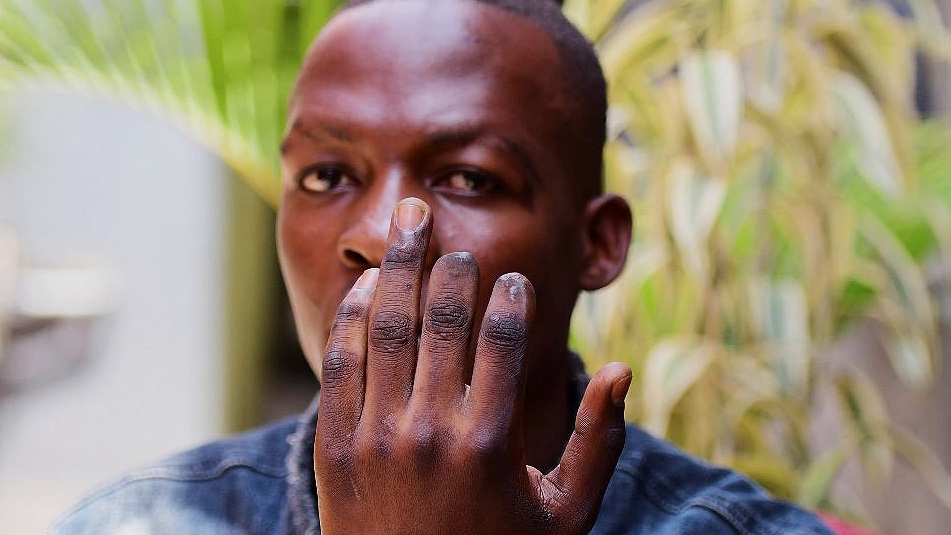 cobbo3's tweet photo. On Monday, a 22-year-old Ugandan opposition supporter shows two fingers he partially lost - he alleges after being tortured by security agents.  HRW released a report the next day condemning the govt for not holding officials accountable for such abuses.
📸Reuters/BBC https://t.co/HoHyaIVixQ
