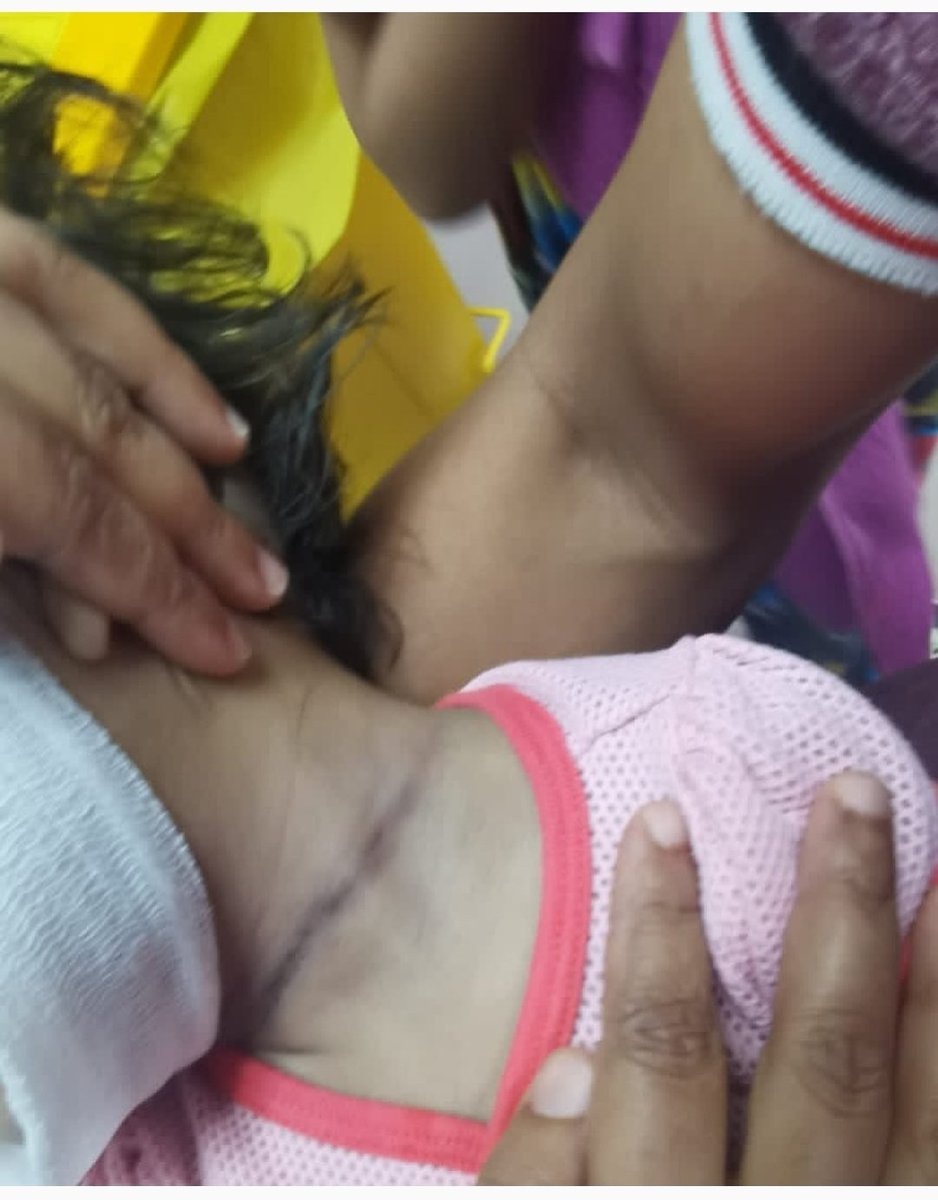 nasrmediamy's tweet photo. 32 hari selepas pemergian baby syifaa. Masih tiada tangkapan dibuat. Semoga kematian #babysyifaa terbela. Manusia paling pukimak adalah manusia yg pukul dan dera budak. https://t.co/sZMdslndkN