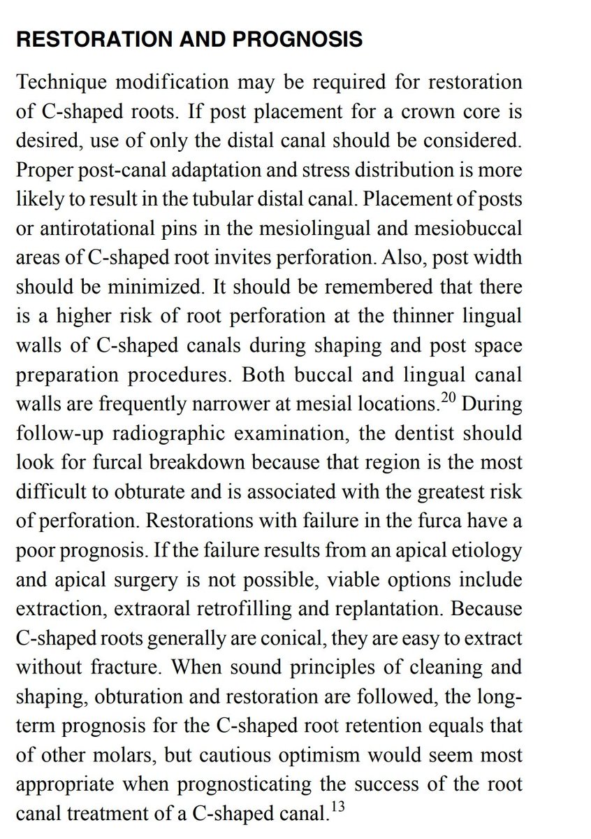 C-Shaped canal

#Dental_by_Hadeel https://t.co/CRZ8J8e2ER