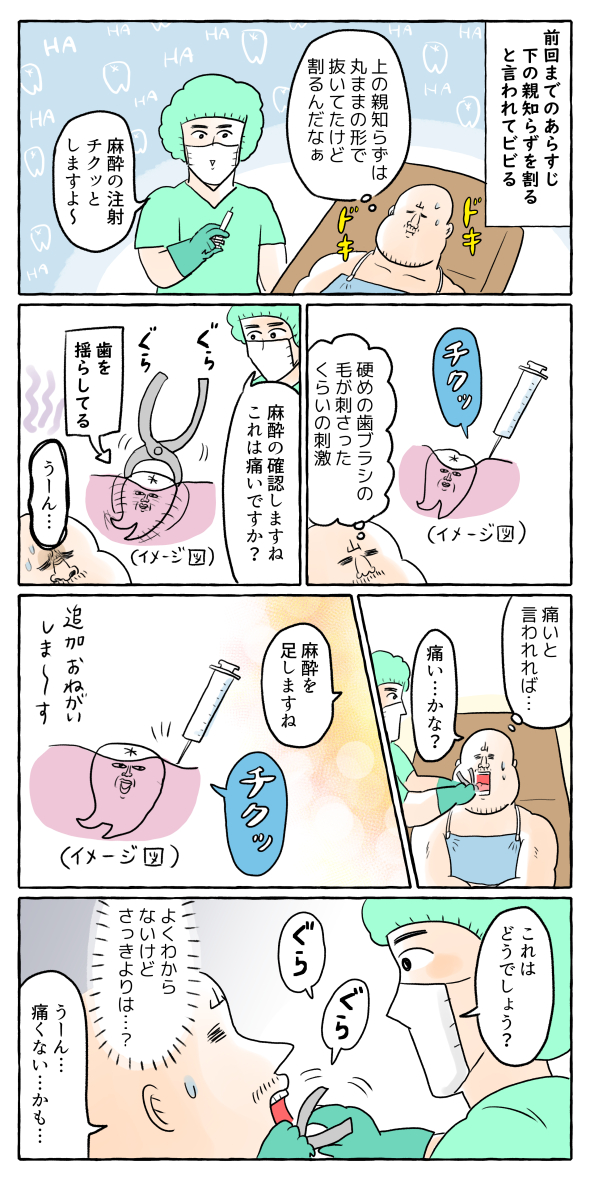 【歯】下の親知らず抜いた話② 