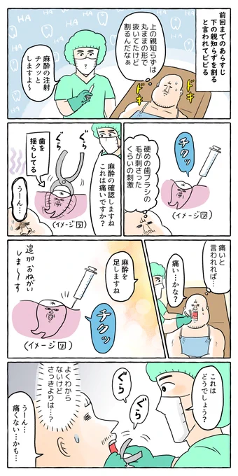 【歯】下の親知らず抜いた話② 