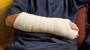 stevesolomon's tweet photo. Do they still makes casts out of plaster?  Do kids still get them signed by their friends? Lots of cast talk today with @scottlinn_ and me. Also, hurting yourself sneezing, the Sweet 16, and trying to understand World Cup qualifying. Hear the whole show at https://t.co/u4R08kxyZ3 https://t.co/EMJ9WgFefg