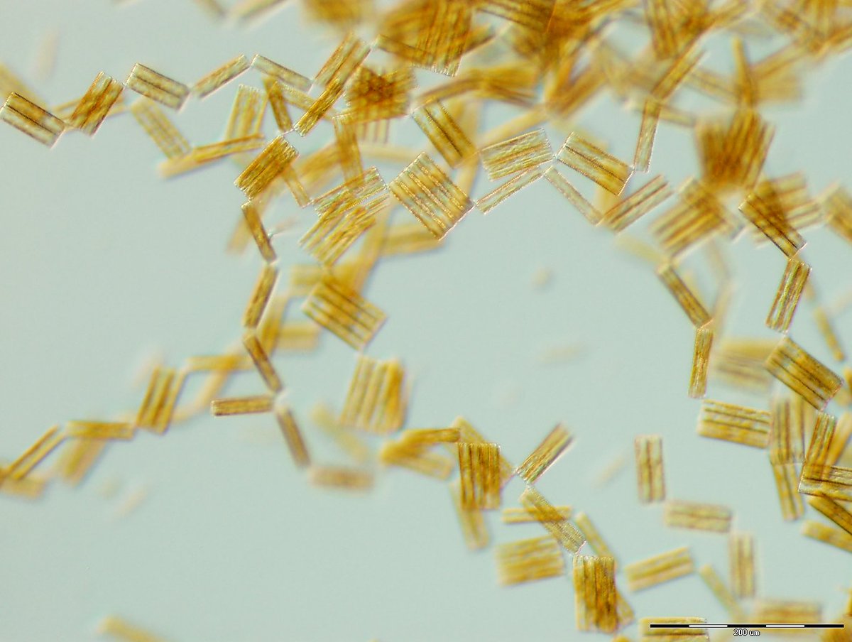 Kalipster's tweet photo. After spending too much time with Excel tables and R, it's refreshing having a look on these creatures as they are in reality. A typical spring assemblage from lake #Balaton.
#diatoms #algae #phytobenthos https://t.co/5636S3Wkzp