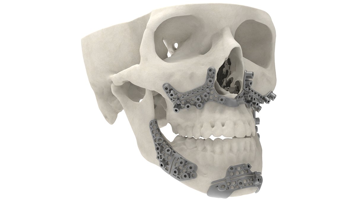 3D Systems’ EVP, Healthcare Solutions, Menno Ellis recently spoke with <a href="/TheTCTMagazine/">TCT Magazine</a>’s Head of Content, <a href="/Leanaura/">Laura Griffiths</a> sharing our continual growth within #additivemanufacturing in the #healthcare space and forward-thinking progressions to come. bit.ly/365wdC8
