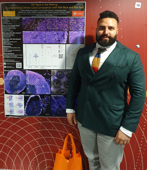 J_Cell_Sci's tweet photo. Also check out the 'First person' interview with Badwi (Bobby) Boumelhem @Biologist_Bobby on work he did while a Postdoc @DrStuartFraser1 @blood_lab @Sydney_Uni, developing an assay for intracellular flow cytometric lipid analysis: https://t.co/CEYPqWPFSs https://t.co/0aN8bNXaYw