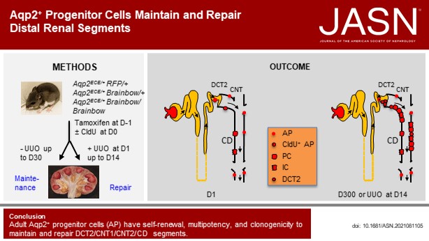 JASN_News's tweet photo. Do adult progenitor cells exist in adult mammalian kidneys? This study provides convincing and conclusive data demonstrating that cells expressing Aqp2 &amp; V-ATPase subunits B1 &amp; B2 function as Aqp2+ progenitor cells in the adult mouse kidney https://t.co/uceEhzHByR https://t.co/i5oZlE7Hwd
