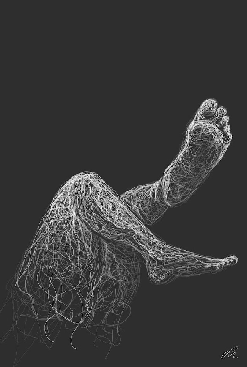 LisaaWin's tweet photo. You can’t always see chronic pain in others. My collection, Where It Hurts, highlights those areas that hurt the most &amp; gives you a glimpse of how it feels when your own body attacks itself. On sale for .08 ETH https://t.co/efenj7ERz4 https://t.co/H4cNoLnLFi