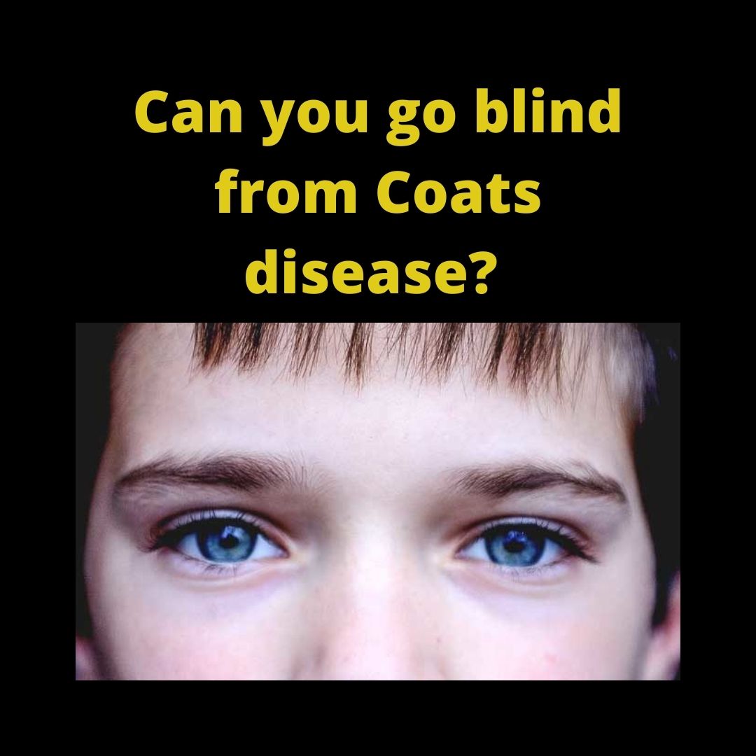 with_darian's tweet photo. In Coats disease, retinal capillaries break open and leak fluid. As fluid builds up, the retina begins to swell. it can lead to partial or complete detachment of the retina, leading to low vision or blindness in the affected eye.
#coats #coatsdisease #visionimpairment #eyedisease https://t.co/RIN5iBaqs8