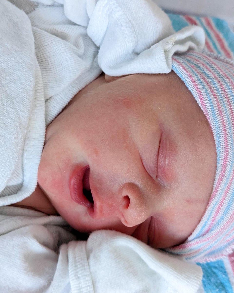 ErikaEKura's tweet photo. Had baby Rowan on 3/23/22– and he was an “en-caul” birth!! Less than 1 in 80,000 babies are born this way; born with their amniotic sac fully intact without water breaking during delivery. #encaul #encaulbirth #encauldelivery #mermaidbirth #veiledbirth https://t.co/N1S0G9Dque