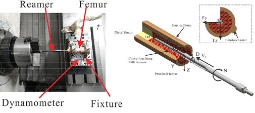 EnginMedicine's tweet photo. Accurate mechanical feedback is critical to the success of virtual and #roboticsurgery. In this study, #reaming force of porcine #femur and #bonesubstitute was measured with a #CNClathe.
https://t.co/zfFV0WGfgY
#Cuttingforce #surgicalrobot #polyurethane https://t.co/55xcItoibW