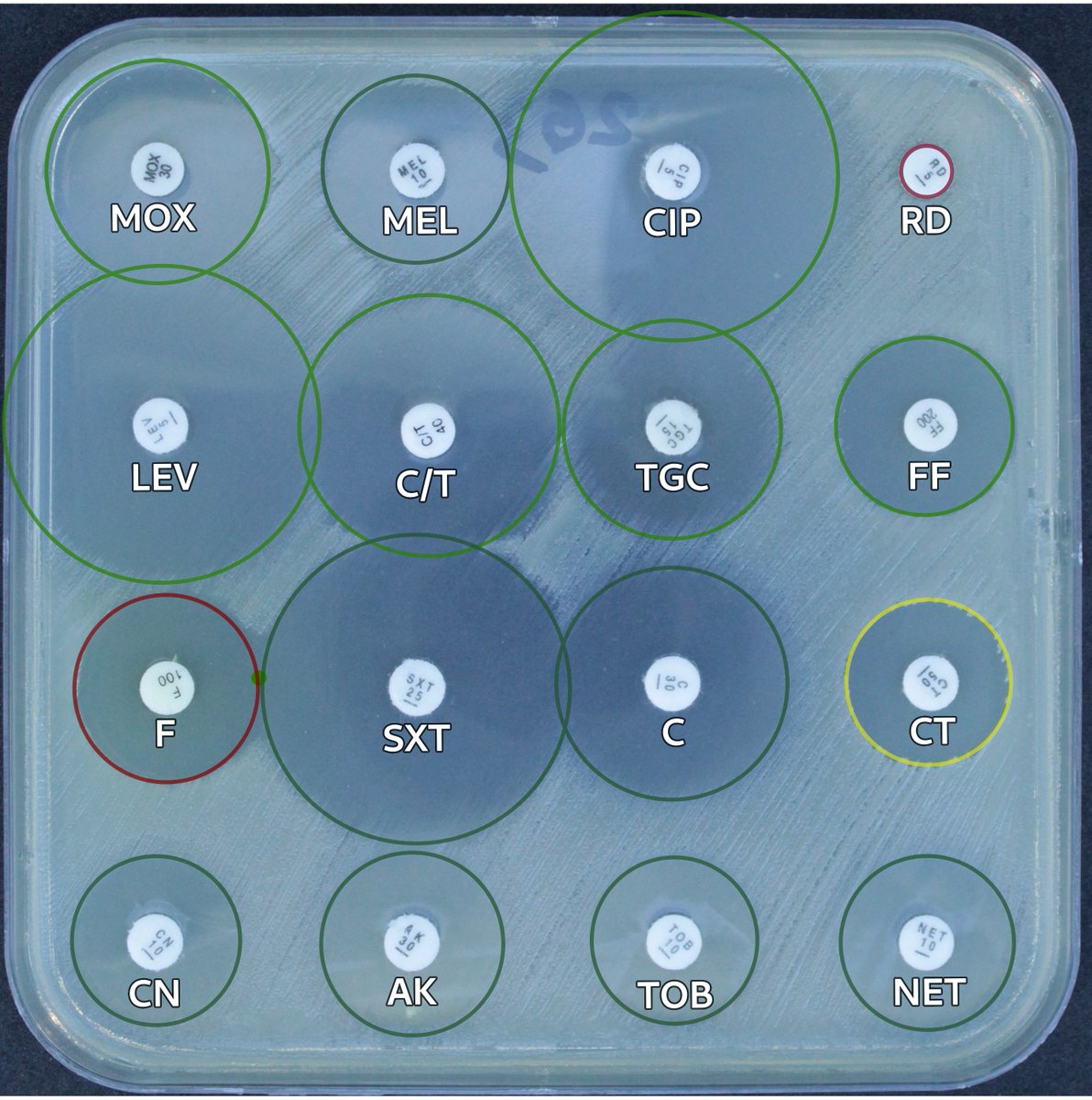 alex_muntean's tweet photo. How #medical #microbiology laboratories check #AntibioticResistance in Enterobacterales. Enterobacter spp. naturally express a chromosomal #cephalosporinase #AmpC. It's (over-)production be can induced by certain #antibiotics. #IDtwitter @Ejike2 #MedEdu #MicroRounds #MicroTwitter https://t.co/tSq2niY80y